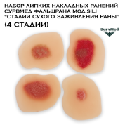 Набор липких накладных ранений SM ФальшРана мод.Sili “Стадии сухого заживления раны” (4 стадии)